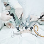 Laparoscopic Surgery