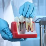 Are $399 Dental Implants Possible? Know The Real Cost